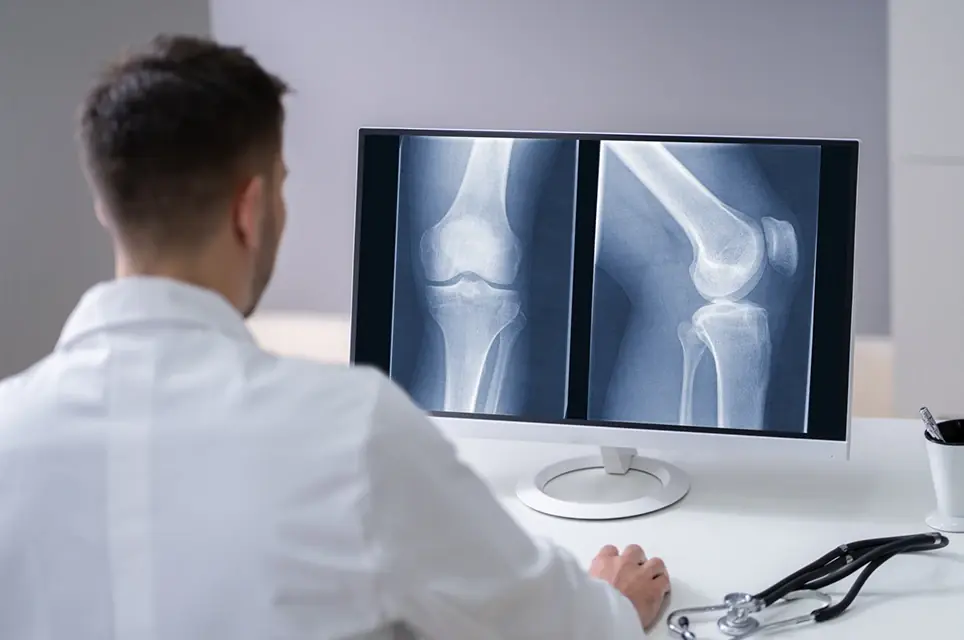 Doctor reviewing knee X-rays on a computer monitor