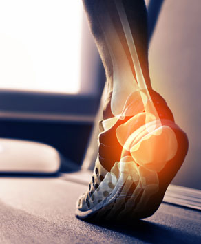 heel pain